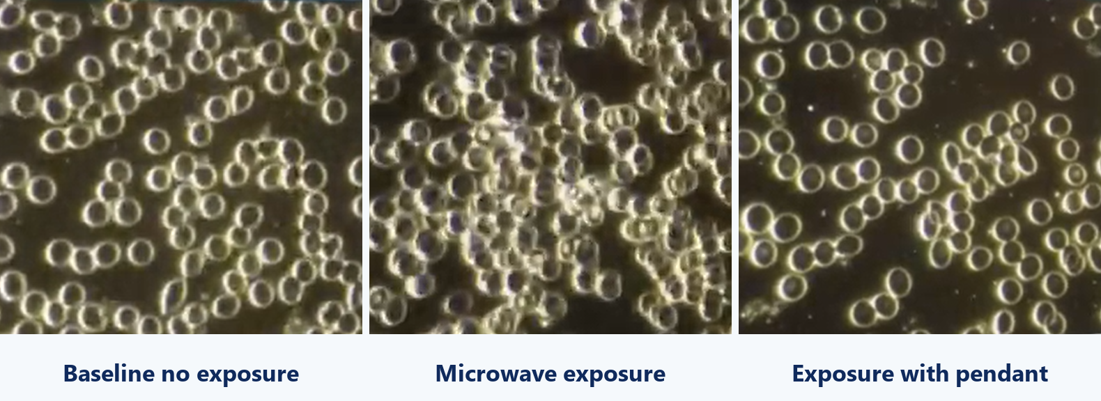 Three-panel live blood analysis from customer Devin: baseline no exposure (left), microwave exposure without a pendant (centre), and the same microwave exposure while wearing an Aulterra pendant (right)